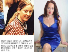 “이집트 여왕처럼 살고파” 총 51회 성형수술 감행