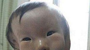 中 ‘철가면’ 쓴채 태어난 아기… 방사능 영향?