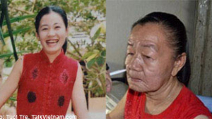 26살 미모 부인이 70세로 ‘폭삭’… 남편 결국