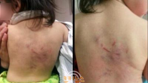 차 안 홀로 2살 여아 피멍들고 골절까지 ‘끔찍’…30대 돌보미 체포
