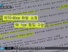 서울아산병원 응급수술기록 “故 신해철, 소장 천공 있었다” 사망 원인은?