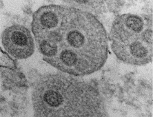 정부 메르스 병원 발표에 평택푸른병원 “환자 거쳐간지 2주… 5분 진료” 분통