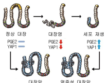 대장 내 재생물질이 대장암 원인?