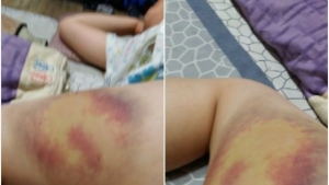 [단독] '폭행하고 상납받고'…전주 운동부 감독 비리 파문