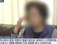 '헤나방' 염모제 피해 막기 위해 '복지부·식약처·공정위' 나서