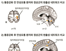 한의학연, 정상인과 만성 요통 환자 ‘뇌 신경망’ 차이 밝혀