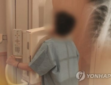 8월부터 만 54~74세 ‘장기흡연자’ 폐암검진 실시