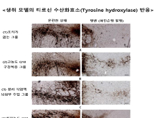 뇌에 직접 항산화제 투여하니 파킨슨병 멈췄다 