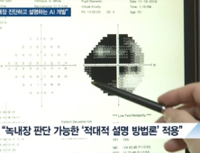 [쿠키건강뉴스] “녹내장 진단부터 설명까지”…현장활용 높인 AI 개발