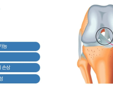 [건우리포트] 방치하면 더 큰 병 되는 십자인대파열