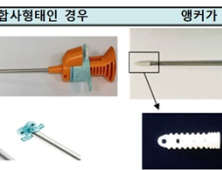 관절수술용 '앵커타입 골절합용나사'  허가 기준 마련