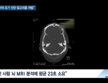 [쿠키건강뉴스] “알츠하이머병 조기 진단 ‘딥러닝 알고리즘’ 개발”