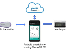 1형당뇨병 환자 위한 인공췌장 앱 개발…'인슐린' 자동 주입