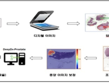 국내 최초 AI 기반 전립선암 진단 소프트웨어 'DeepDx-Prostate' 허가