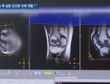 [쿠키건강뉴스] “노년층 수술 후 섬망 있으면 치매 위험 급증”