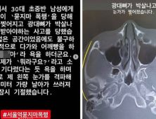 ‘서울역 묻지마 폭행’ 피해자 “겉보기엔 멀쩡한男…한 대 더 치려해”