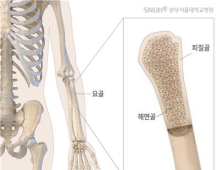 ‘악력’ 강할수록 손목뼈 골밀도 높다