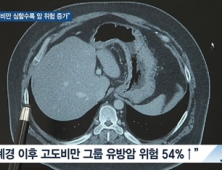 [쿠키건강뉴스] “폐경 후 비만 심할수록 암 발생 위험 증가”