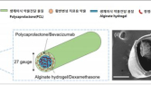 국내 의료진, 주사 효과 4배 지속 안구 임플란트 개발