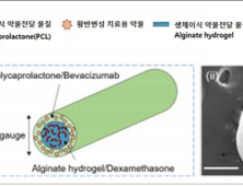 국내 의료진, 주사 효과 4배 지속 안구 임플란트 개발