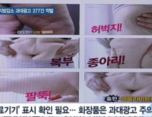 [쿠키건강뉴스] ‘흉터 치료’·‘지방 감소’ 온라인 과대광고 377건 적발