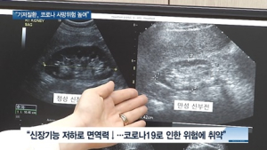 [쿠키건강뉴스] “당뇨·고혈압 기저질환, 코로나 사망위험 높여”