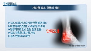 [쿠키건강뉴스] “그물 모양 ‘개방형 깁스’ 착용 만족도 높아”
