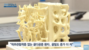 [쿠키건강뉴스] “척추관협착증이 골다공증 치료 방해하는 위험인자”