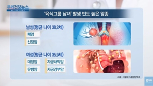 [쿠키건강뉴스] “고기 즐기는 남성 ‘폐암’·여성 ‘대장암’ 빈도 높아”