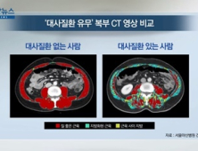 [쿠키건강뉴스] “지방 적은 질 좋은 근육 많으면 대사질환 위험 낮아”