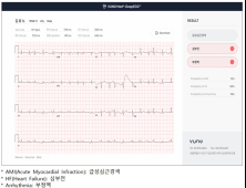 심전도로 '심부전·심근경색' 탐색…'제16호 혁신의료기기' 지정