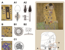 클림트의 ‘키스’…의학의 관점에서 해부하다 外 [병원소식]