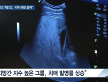 [쿠키건강뉴스] “비알코올성 지방간, 노년기 치매 위험 높여”