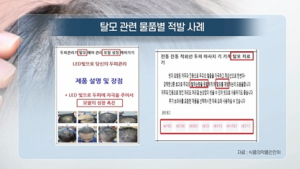 [쿠키건강뉴스] “탈모에 효과” 의약품·기기 온라인 불법광고 257건 적발