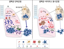 연세대 연구팀, 바이러스 감염 인한 결핵 악화 기전 규명