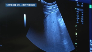 [쿠키건강뉴스] “탄수화물 많이 먹으면 비알코올성 지방간 위험 커져”