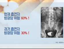 [쿠키건강뉴스] 흡연자 방광암 위험 60% 높아…“혈뇨 보이면 원인 검사”