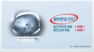 [쿠키건강뉴스] “황반변성 생기면 알츠하이머·파킨슨병 위험 증가”