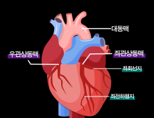 좁아진 관상동맥, 새 혈관길 내서 치료한다