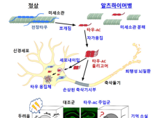 ‘타우 단백질’ 치매 발병 기전 알아냈다… 치료제 개발 가능성 제시