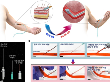 카이스트, 체온으로 부드럽게 변하는 정맥 주사바늘 개발
