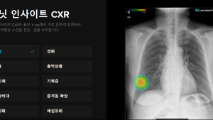 ‘보험 진입’ 2번째 혁신의료기술…루닛이 선점할까