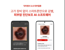  “휴대폰으로 피부암 감별”…AI 소프트웨어 임상 성공