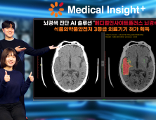 SK C&C, 뇌경색 진단 AI 솔루션 식약처 허가 획득