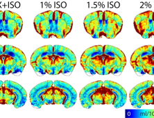 저산소증 활용한 MRI 뇌혈류 반복 촬영법 개발