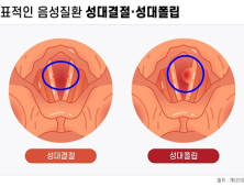 목소리 오남용 원인인 ‘이 병’ [건강 나침반] 