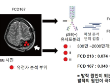 '뇌세포 극미량 돌연변이가 뇌질환 유발'