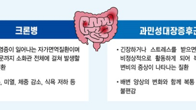 평생 동고동락 ‘크론병’, 증상 조절로 일상생활 가능 [건강 나침반]