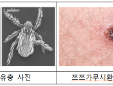 ‘야외활동 시 쯔쯔가무시증 주의’...