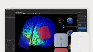 뉴로핏, 의식장애 ‘맞춤형 tDCS 솔루션’ 혁신의료기기 지정